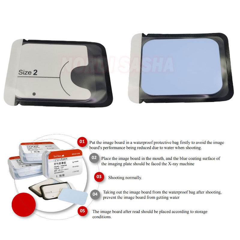 1 Buah Pelat Gambar Fosfor Gig - Medical X ulasan dan harga